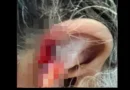 Neto arranca pedaço da orelha da avó e diz à polícia que engoliu