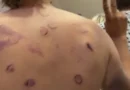 Hematomas e fraturas: ativistas da flotilha falam em tortura em Israel