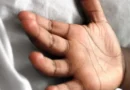 Menino de 11 anos morre após suspeita de envenenamento com bolo no RJ
