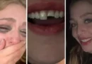 Jovem quebra dente na balada no PR, cola na madrugada e volta para a festa