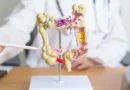 Pacientes com câncer colorretal têm medicamento aprovado pela Anvisa
