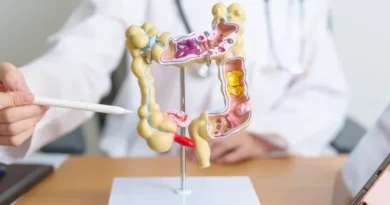 Pacientes com câncer colorretal têm medicamento aprovado pela Anvisa