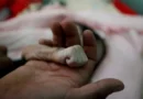 Conflito no Iêmen: ONU aponta recorde de pessoas passando fome